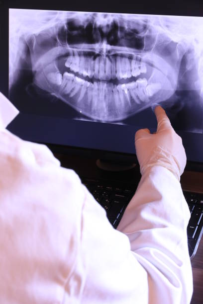 Best Emergency Broken Tooth Repair in Mira Monte, CA